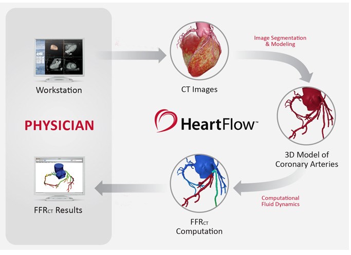 The HeartFlow FFR calculation process.